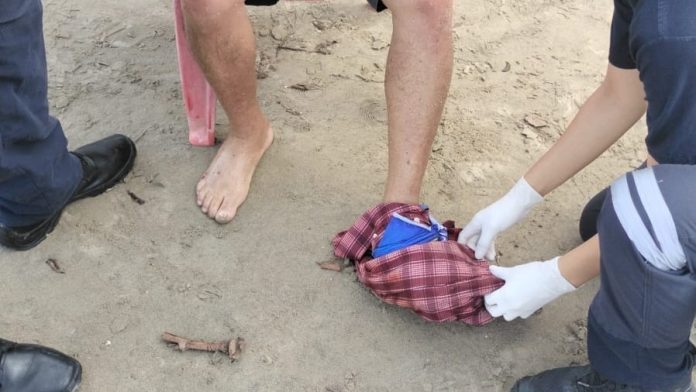 Pescador lesionado de 72 años en su pie izquierdo al quedar atrapado en la propela de su lancha en la playa Guayabitos, Nayarit